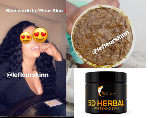 5D Herbal Whitening Soap *** UPGRADED W/ KOJIC ACID***
