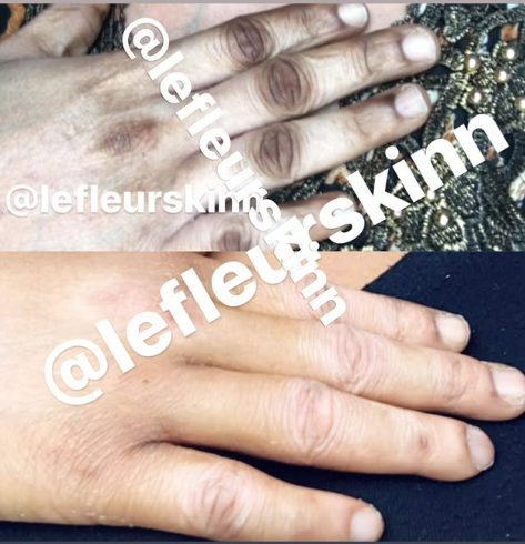 EXTREME DARK KNUCKLE SET