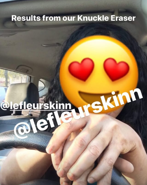 EXTREME DARK KNUCKLE SET