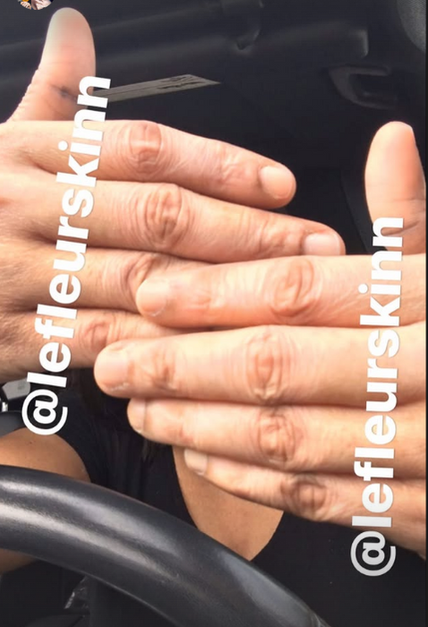 EXTREME DARK KNUCKLE SET