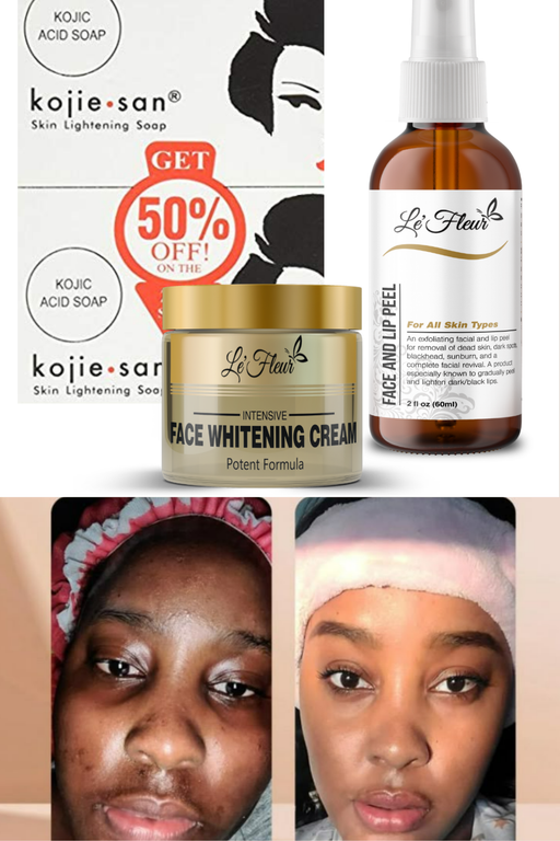 HYPERPIGMENTATION SET-100ml/3.5oz