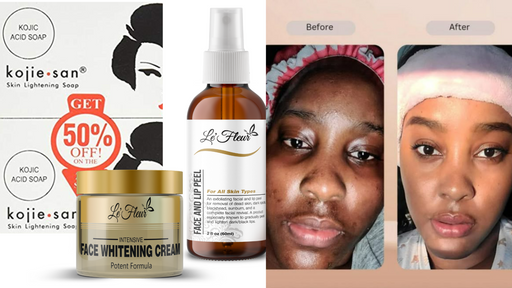 HYPERPIGMENTATION SET- 60ml/2oz