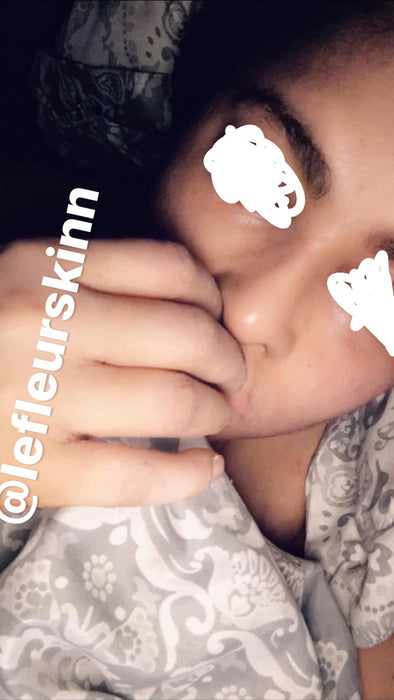 5D Herbal Whitening Set