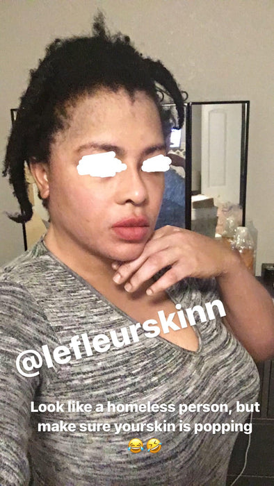 5D Herbal Whitening Set