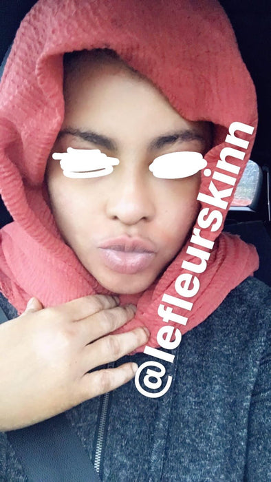 5D Herbal Whitening Set