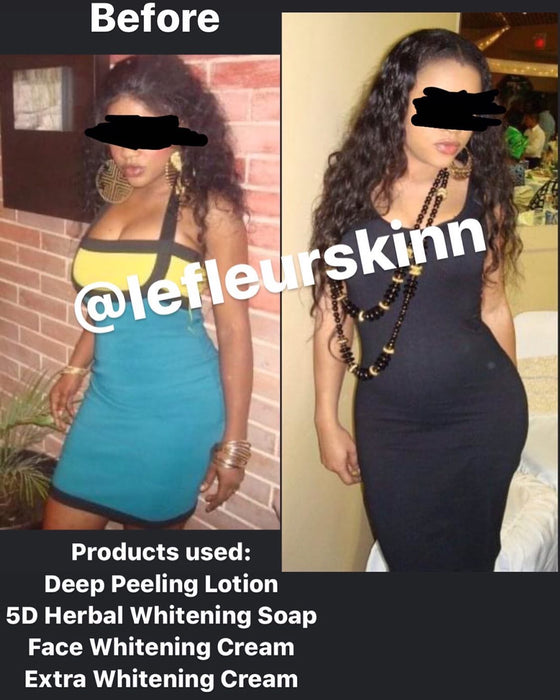 5D Herbal Whitening Set