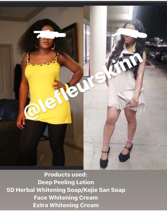 5D Herbal Whitening Set