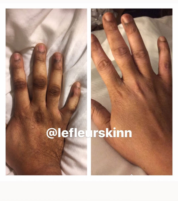 DARK KNUCKLE PEEL