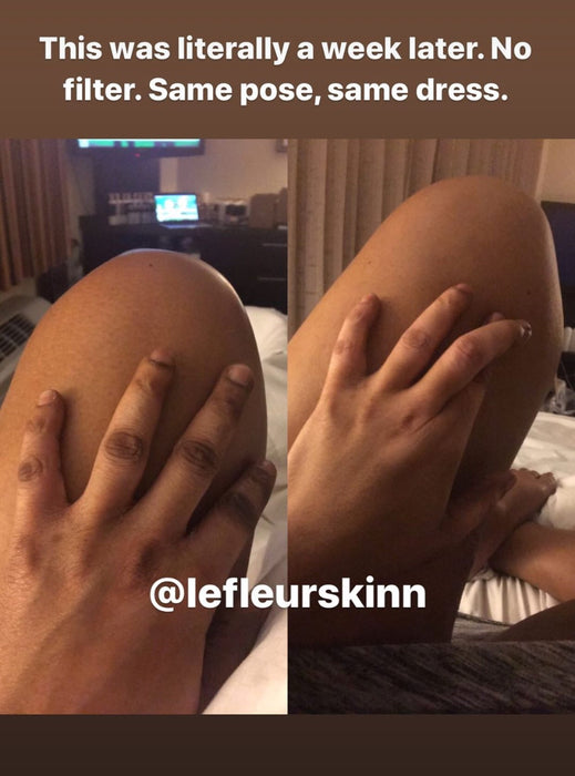 DARK KNUCKLE PEEL