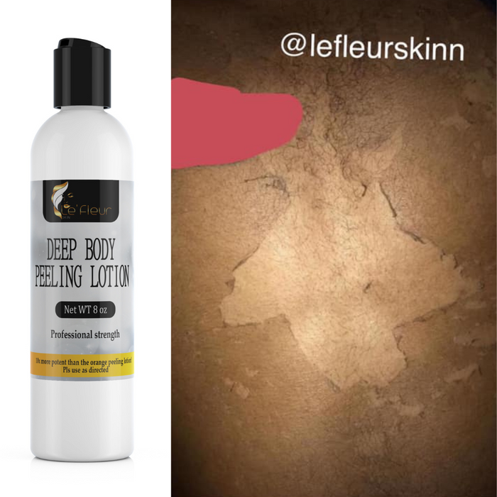 DEEP BODY PEELING LOTION