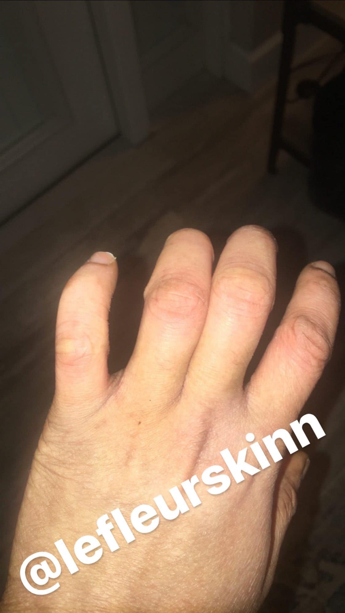 KNUCKLE ERASER CREAM Lefleurskin