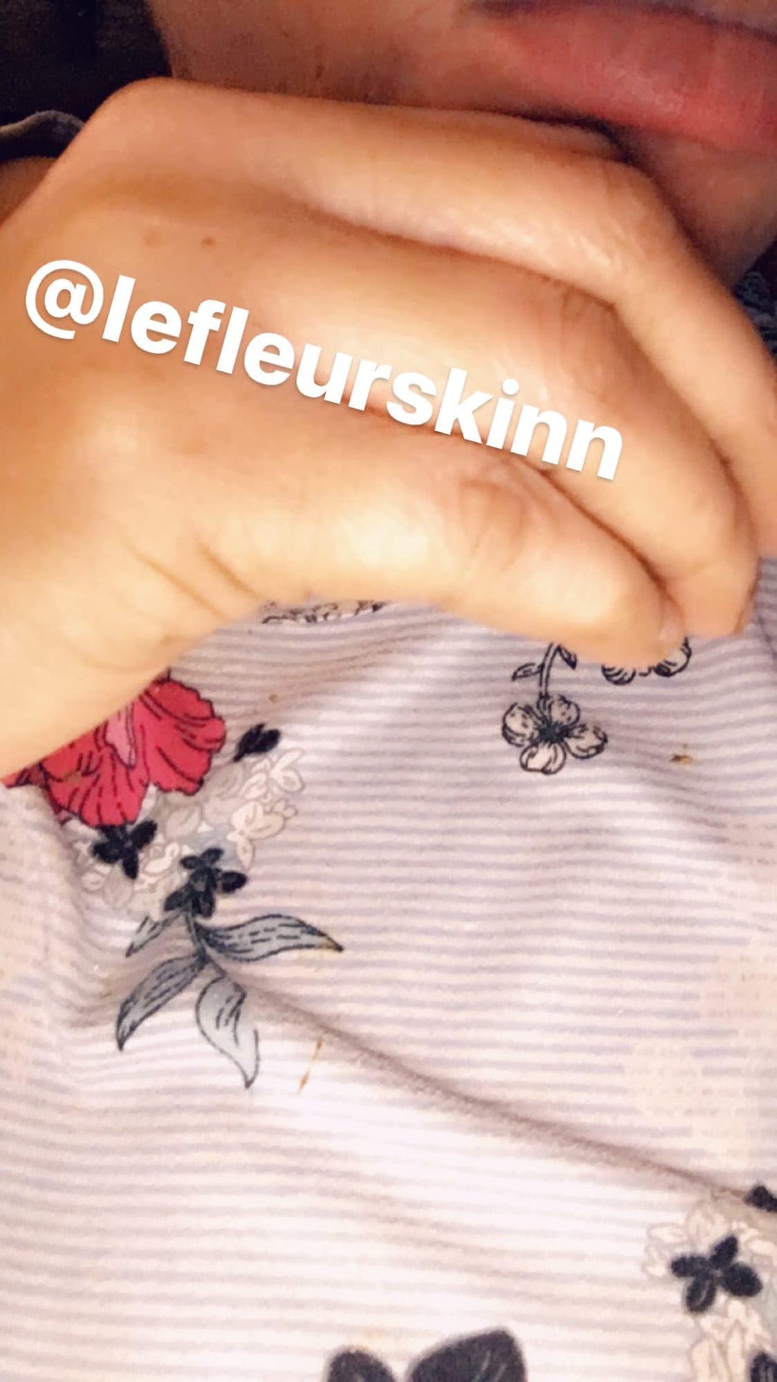 KNUCKLE ERASER CREAM Lefleurskin