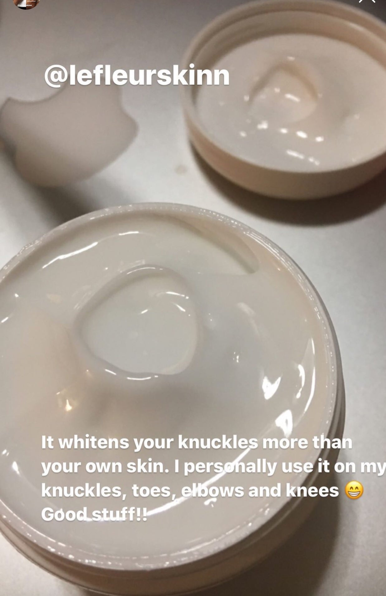 KNUCKLE ERASER CREAM Lefleurskin