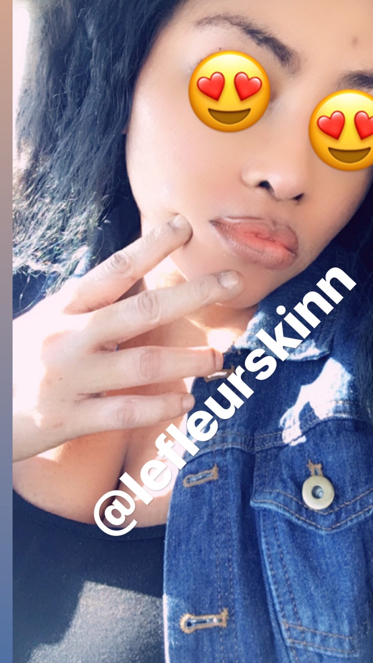 EXTRA WHITENING CREAM/KNUCKLE ERASER SET 16oz/500ml Lefleurskin