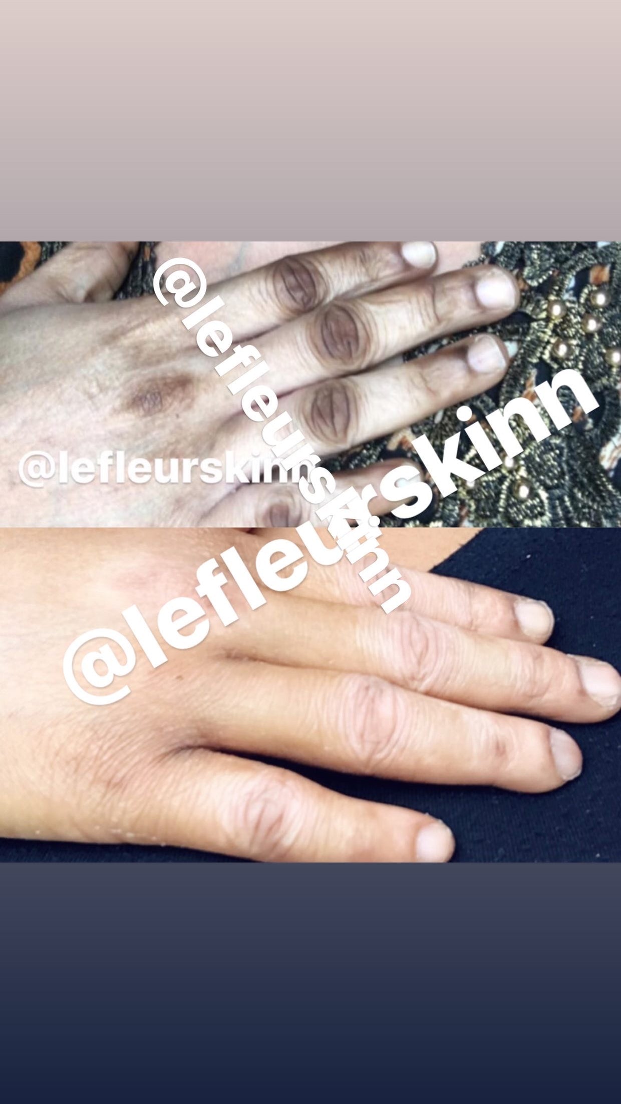 KNUCKLE ERASER CREAM Lefleurskin