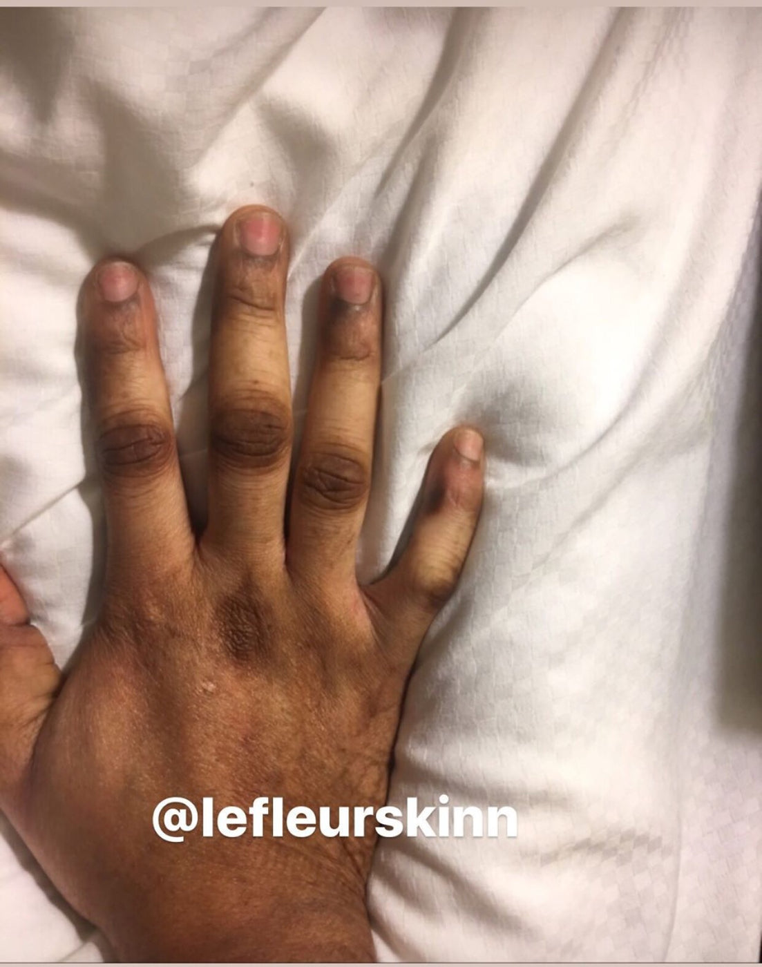 KNUCKLE ERASER CREAM Lefleurskin