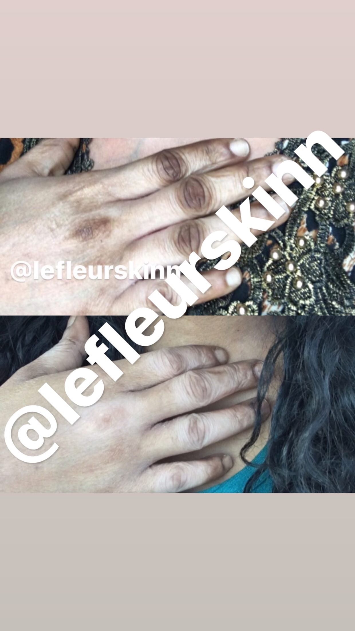 KNUCKLE ERASER CREAM Lefleurskin
