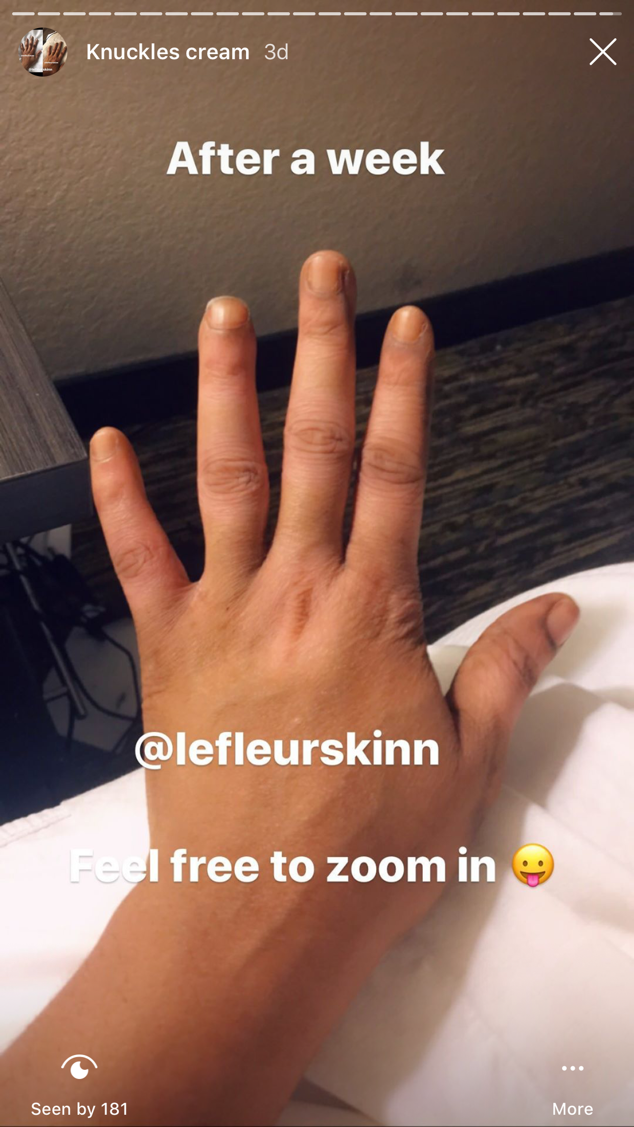 KNUCKLE ERASER CREAM Lefleurskin
