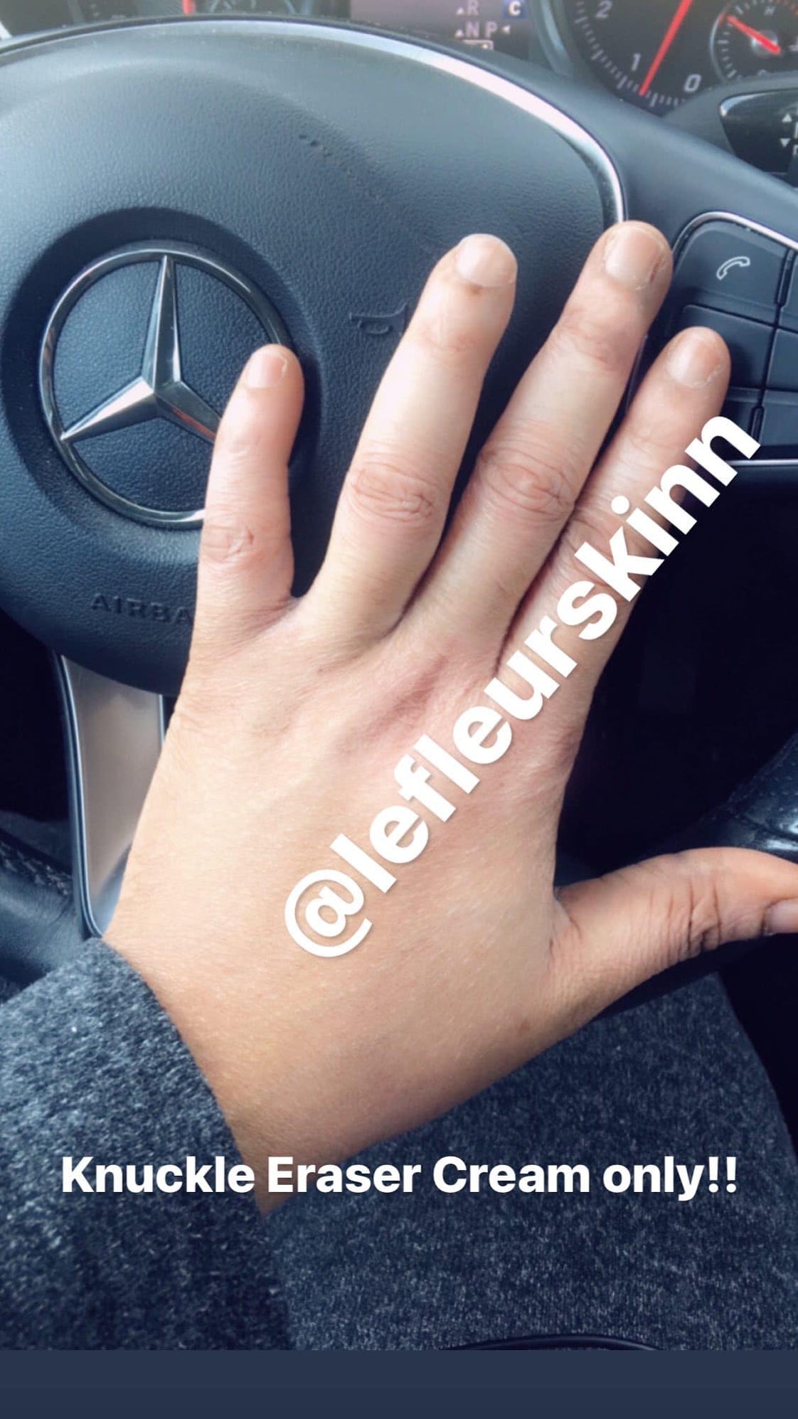 KNUCKLE ERASER CREAM Lefleurskin