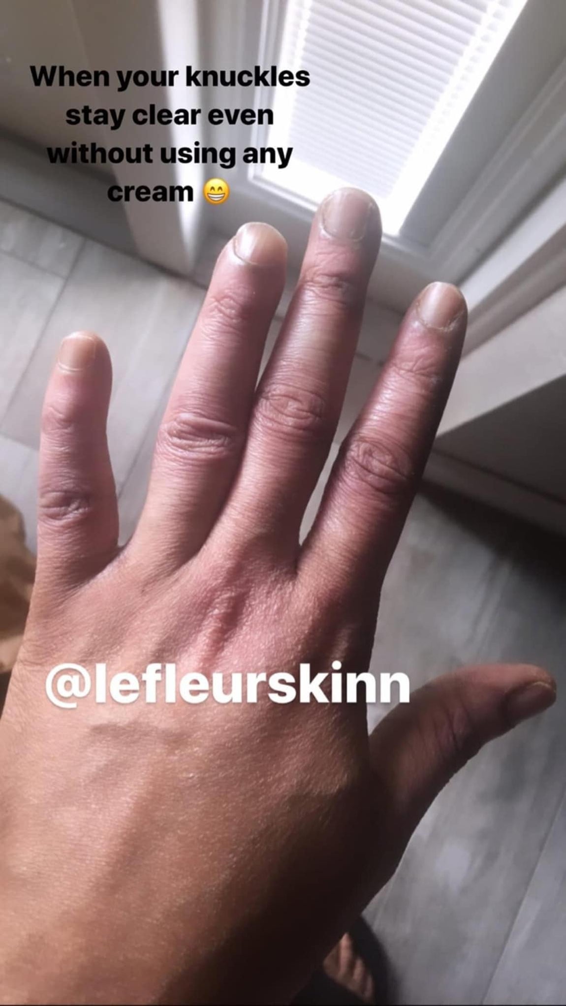 KNUCKLE ERASER CREAM Lefleurskin