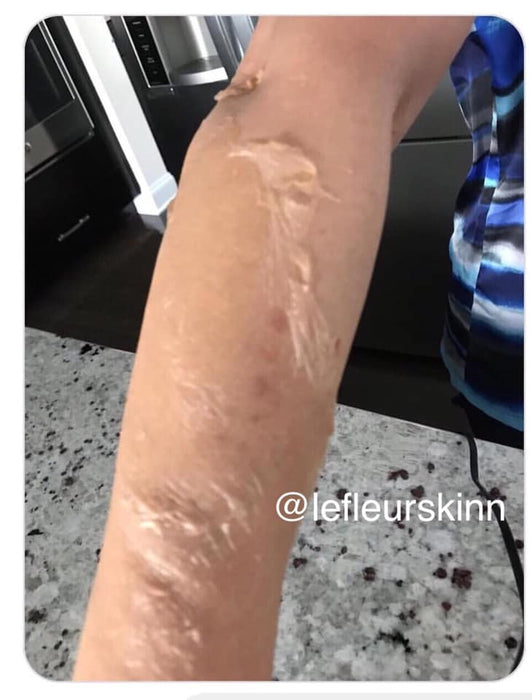DEEP BODY PEELING LOTION
